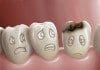 coconut-oil-post-tooth-infection-featured