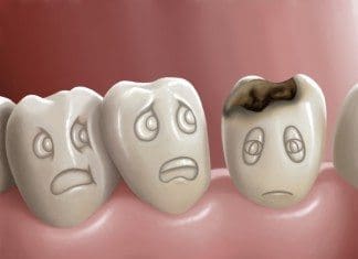 coconut-oil-post-tooth-infection-featured